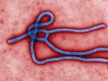 vírus ebola vírus ebola