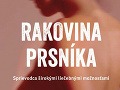 Na rakovinu prsníka ochorie Na rakovinu prsníka ochorie