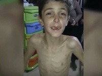 Takto vyzerá sedemročný sýrsky chlapec. Takto vyzerá sedemročný sýrsky chlapec.