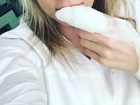 Katarína Štumpfová si spôsobila nepríjemné zranenie. Katarína Štumpfová si spôsobila nepríjemné zranenie.
