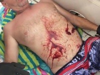 Erwin bol po incidente celý od krvi Erwin bol po incidente celý od krvi