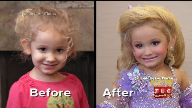 Pred a po zmene vizáže, ktorú musia dievčatká kvôli kontroverznej súťaži podstúpiť