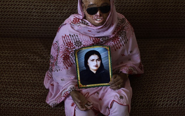 Naziran Bibi (25) sa v roku 2008 stala obeťou svojho manžela a jeho prvej ženy.