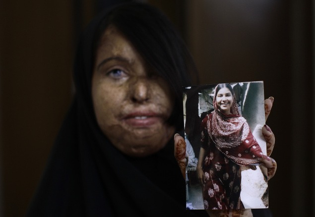 Naila Farhat (22) pred útokom a po útoku.
