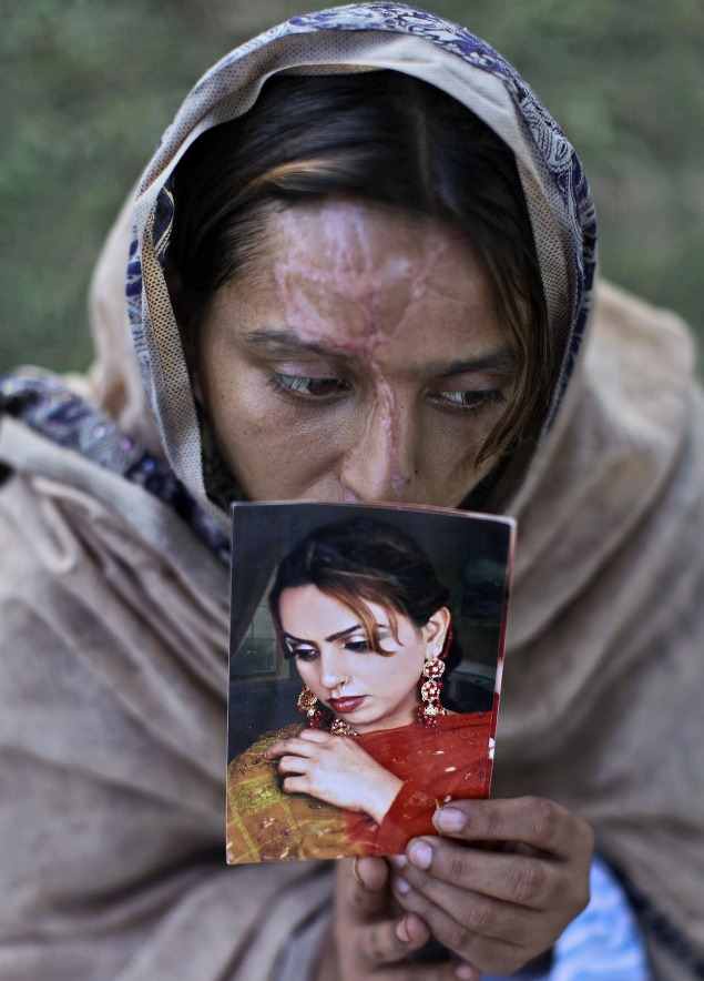 Shamma Maqsood (24) drží fotografiu, ako vyzerala pred útokom svojho manžela v marci 2012.
