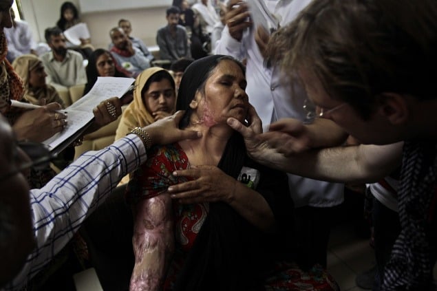 Parveen Aslam (42) počas vyšetrenia lekárom. Ju aj jej dcéru napadol odmietnutý uchádzač o ruku.