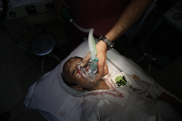 Akhtar Yar (9) počas operácie nosa. Na dievča a jej otca zaútočil v roku 2004 muž, s ktorým mali predtým hádku.