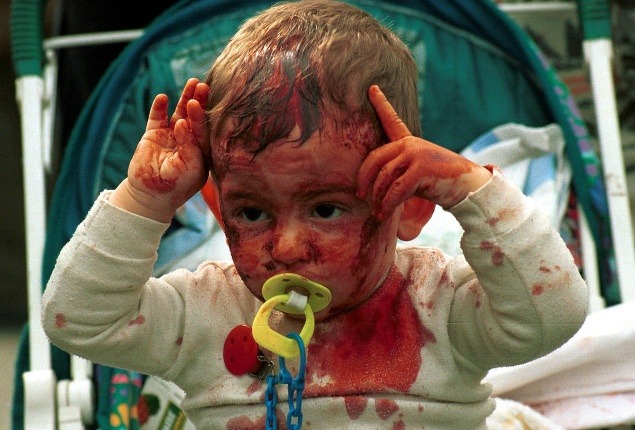 Pohľad na zakrvavené dieťa šíitskych moslimov Mahmúda Sliemana, ktorého mečom dorezala jeho matka, v juholibanonskom meste Nabatíja, 2004.