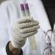 Na�li mut�ciu v�rusu A(H1N1), m��e zhor�it chorobu!