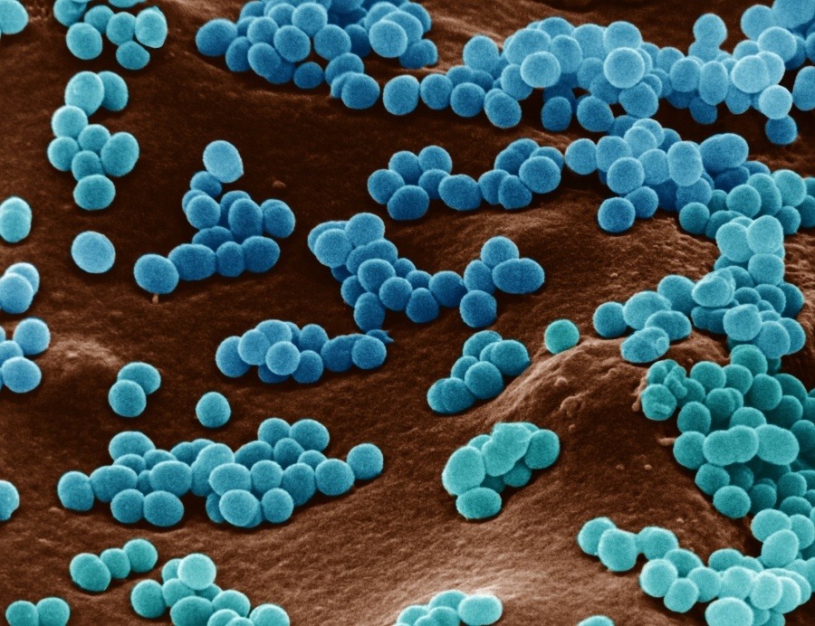 kokken bacterie longen