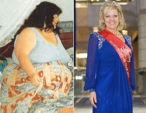 Ťažká obezita: Carole bola
