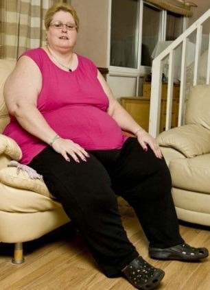Žena s 210 kilami