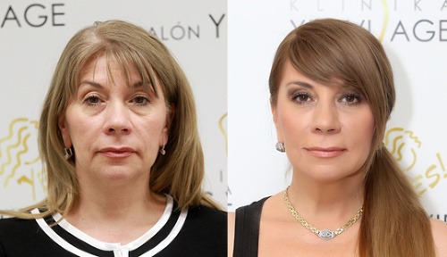 Simona Krainová priznala nielen