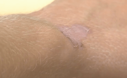 Nezistený druh infekčného ochorenia