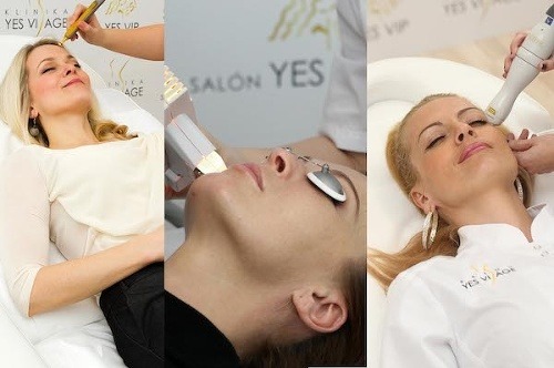 Kam sú až schopné