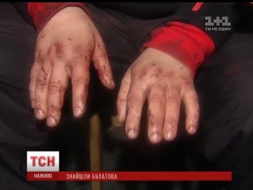 VIDEO Brutality na Ukrajine: