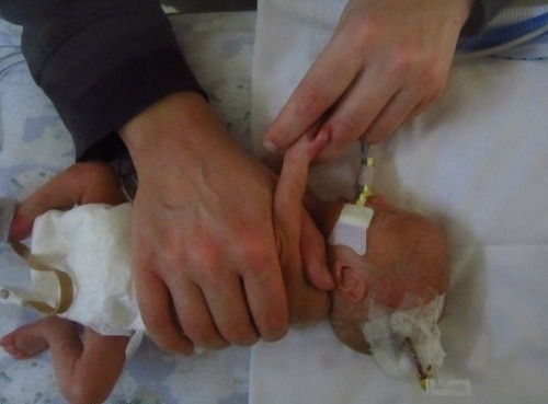 Smrť bábätka v nemocnici: