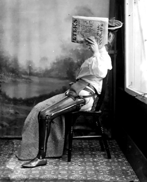 4.Hanblivá žena a jej umelá noha (1890-1900)