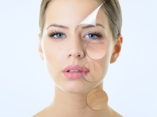 Klinické testy potvrdzujú: Kúra Lagrend Hyaluron Intense Skin Repair Night vyhladzuje dokonca hlboké mimické vrásky.