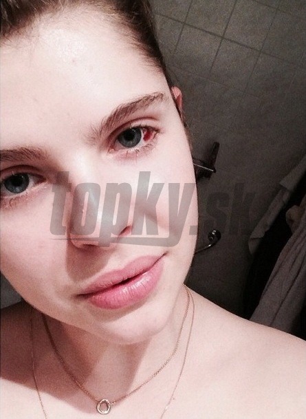 Emma Müllerová sa na sociálnej sieti pochválila fotkou, ktorá zachytáva nové  tetovanie očného bielka. 