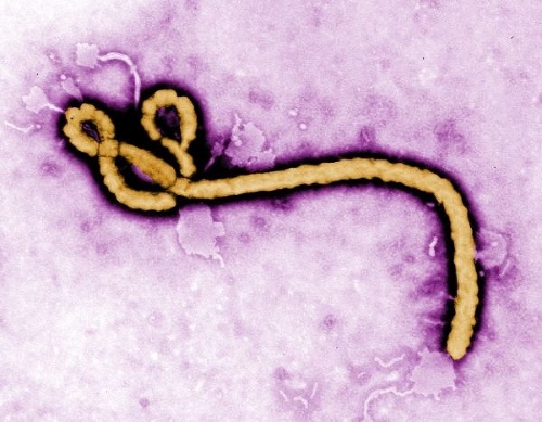 Toto je vírus Eboly