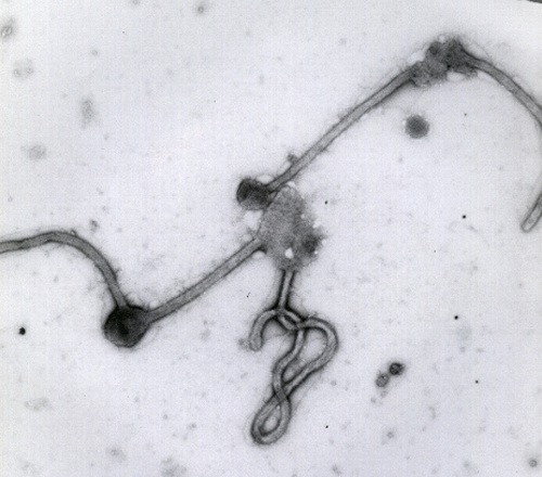 Vírus eboly pod mikroskopom