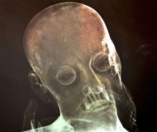 Hrôzostrašné odhalenie: Zröntgenovali sochu