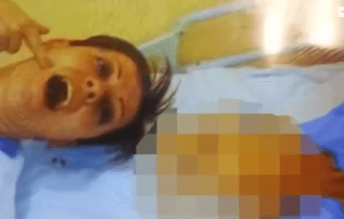 Zvrátená fotografia Daniely s otvorenými ústami pri mŕtvom pacientovi
