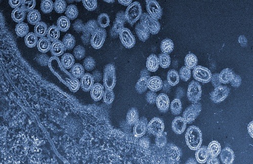 vírus vtáčej chrípky H5N1