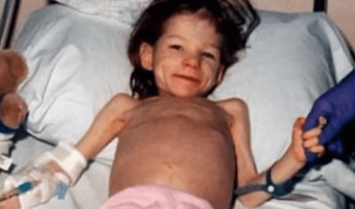 Keď osemročné dievčatko našli, vážilo ako dvojročné dieťa
