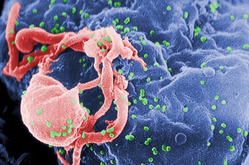 Žena nakazená HIV udivuje