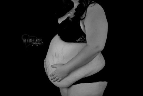 Budúca mamička (25) zverejnila
