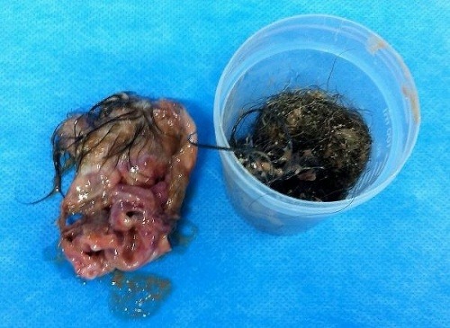 Žena išla prvýkrát ku