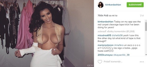 Kim Kardashian ukázala svetu, ako si dopomáha k dokonalým prsiam. 
