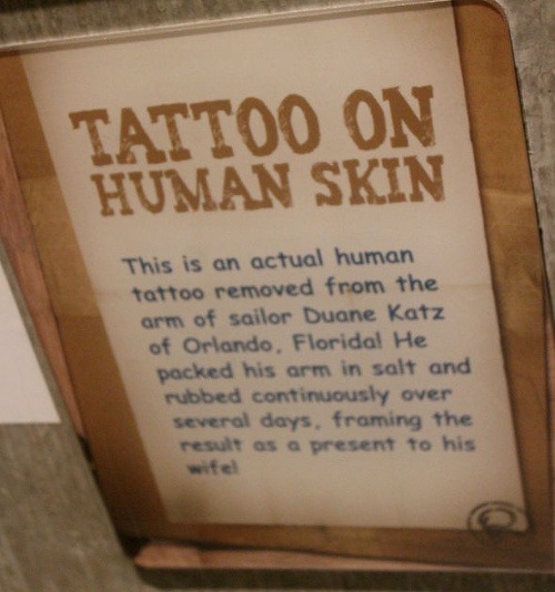 Muž sa zbavil tetovania