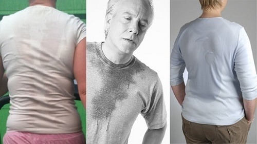 Nadmerné potenie je choroba,