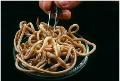 Trpíte dlhodobou únavou, bolesťami