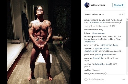 Robbie Williams sa fanúšikom bežne ukazuje nahý. 
