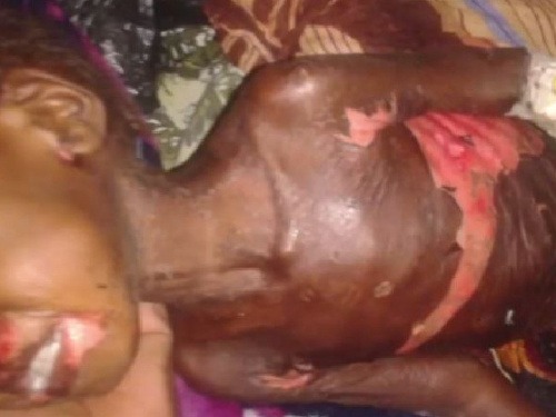 Chemické útoky v Sudáne: