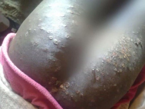 Chemické útoky v Sudáne: