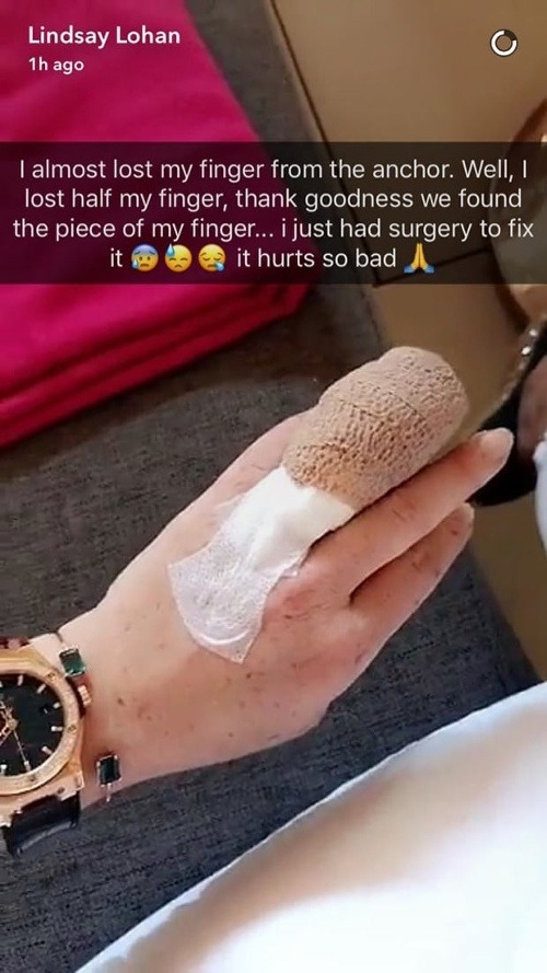 Lindsay Lohan sa o hrozivé zranenie podelila na sociálnej sieti Snapchat.