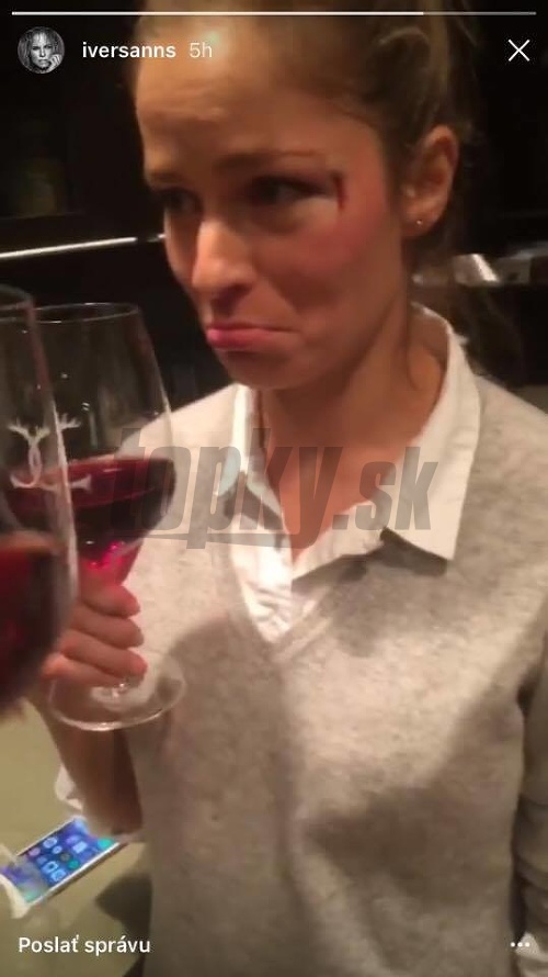 Takto vyzerala Ivana Surovcová pár hodín po zranení. Dopriala si aj pohár vína.