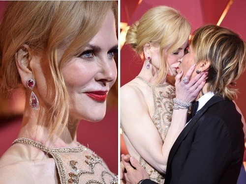 Pre krásu sa trpí! Nicole Kidman sa na krku vytvorili nepekné červené fľaky. Oveľa viac ale zaujala vášnivými bozkami, ktoré si s manželom na červenom koberci vymieňali.