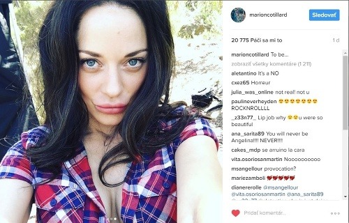 Marion Cotillard zverejnila na instagrame sériu fotiek, na ktorých takto neprirodzene špúli pery. 
