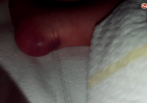 Nepochopiteľná zlomenina novorodeniatka: Mama