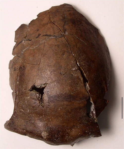 Záhadná lebka z Melanézie