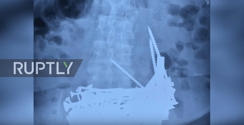 Röntgenová snímka 