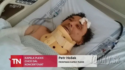 Členovia kapely Plexis skončili v nemocnici so stredne ťažkými zraneniami.