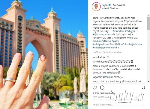Matej Sajfa Cifra sa na Instagrame pochválil zraneným prstom.