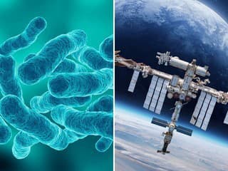 Experti z NASA našli vo vesmíre mutujúcu baktériu: Antibiotiká nepomáhajú, spôsobuje vážne zdravotné problémy